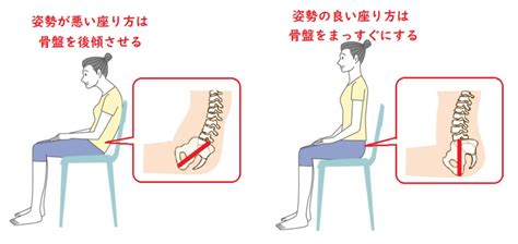 後面座位|「骨盤の前傾・後傾をつくる要因と、それにより起こ。